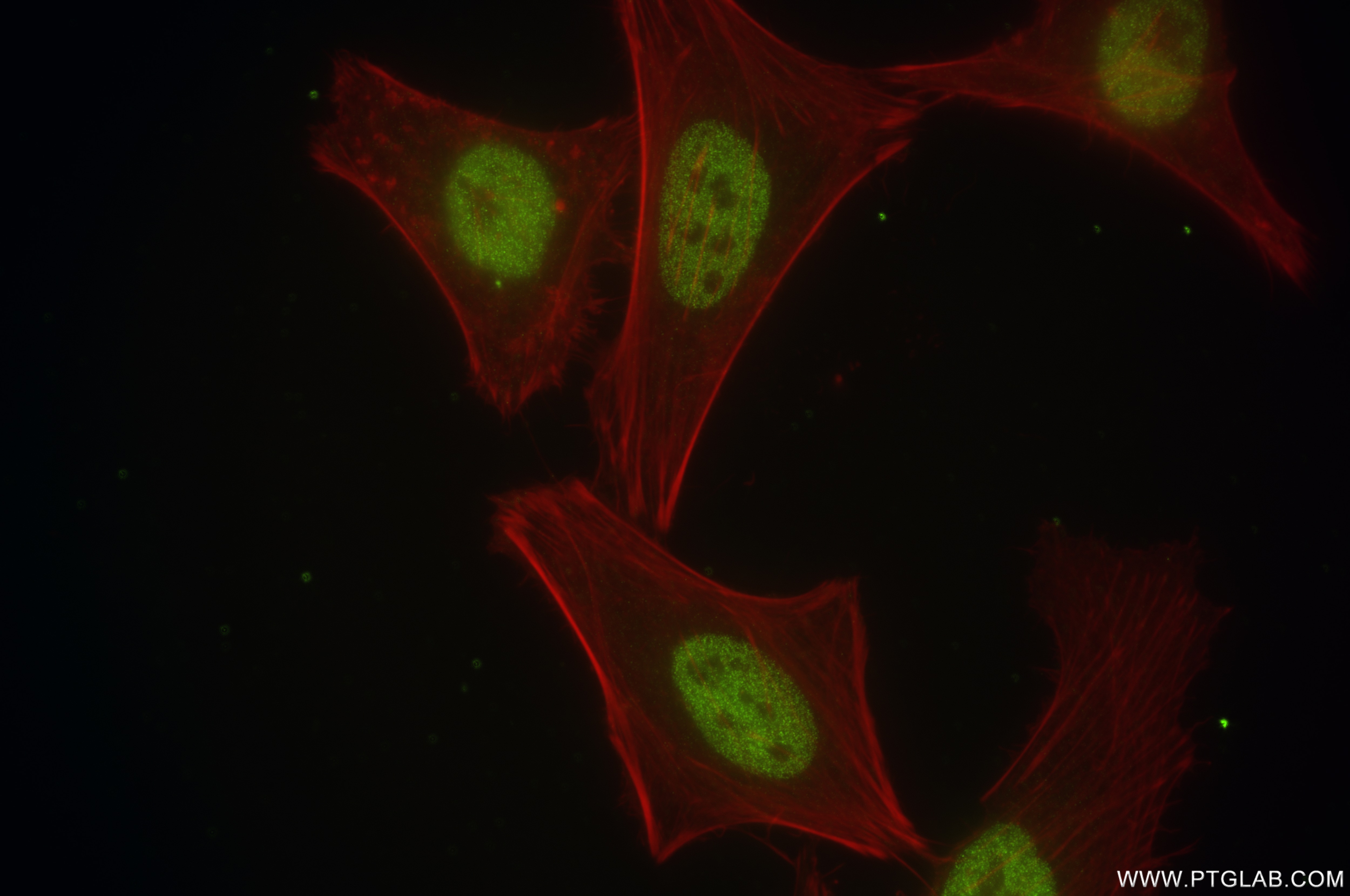 Immunofluorescence (IF) / fluorescent staining of HeLa cells using BRD8 Recombinant antibody (84965-1-RR)