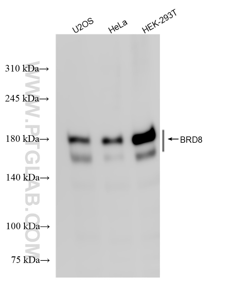 Western Blot (WB) analysis of various lysates using BRD8 Recombinant antibody (84965-1-RR)