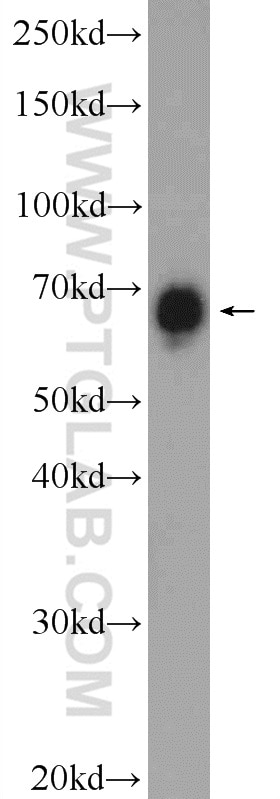 Western Blot (WB) analysis of HeLa cells using BRD9 Polyclonal antibody (24785-1-AP)