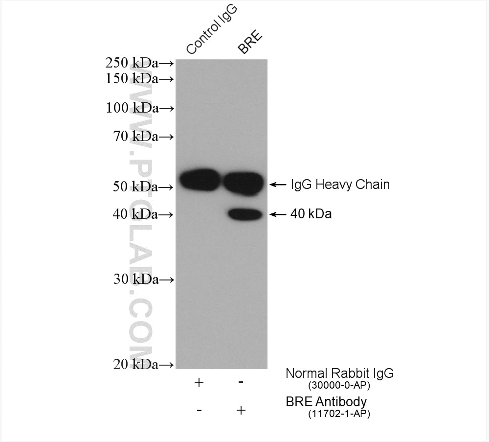 Immunoprecipitation (IP) experiment of HeLa cells using BRE Polyclonal antibody (11702-1-AP)