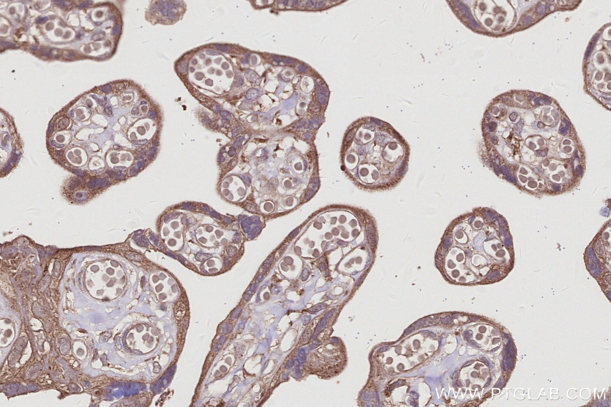 IHC staining of human placenta using 66356-1-Ig Immunohistochemistry (IHC) staining of human placenta tissue using BRE Monoclonal antibody (66356-1-Ig)