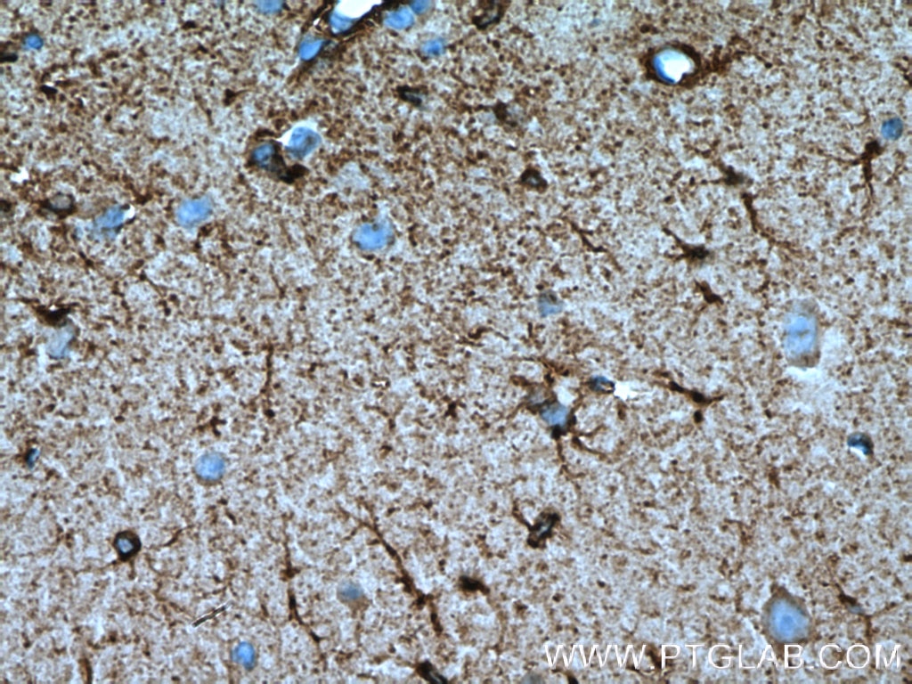 Immunohistochemistry (IHC) staining of mouse brain tissue using BRE Monoclonal antibody (66356-1-Ig)