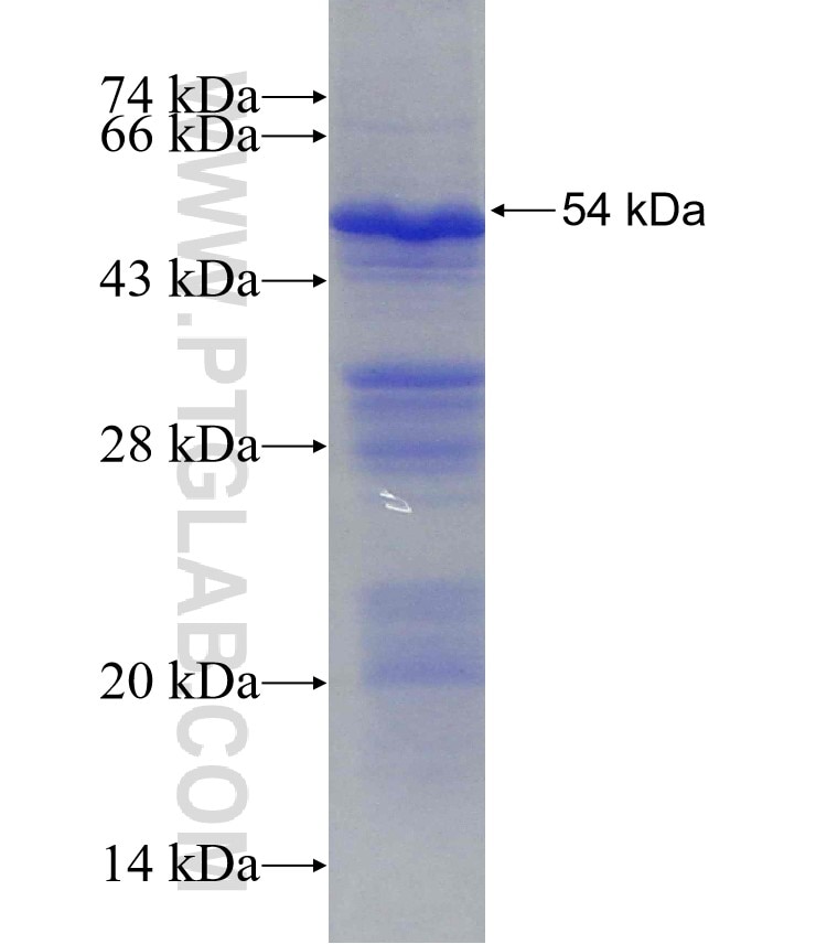 BRE fusion protein Ag2256 SDS-PAGE