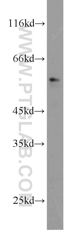 Western Blot (WB) analysis of DU 145 cells using BRF2 Polyclonal antibody (12056-1-AP)