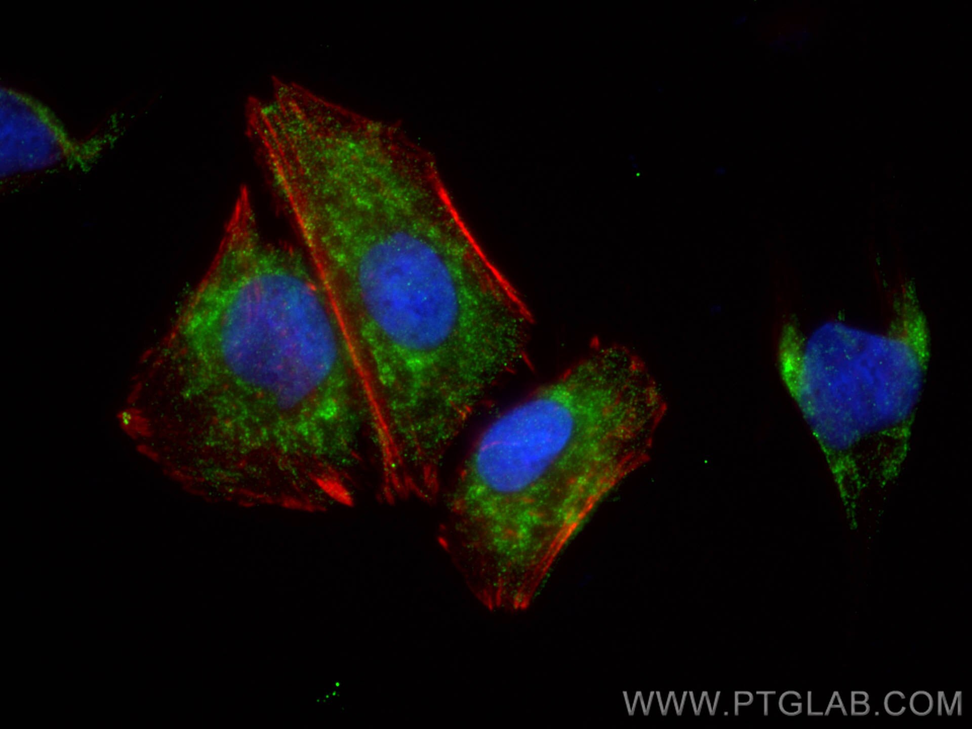 Immunofluorescence (IF) / fluorescent staining of SH-SY5Y cells using BRINP2 Polyclonal antibody (26884-1-AP)