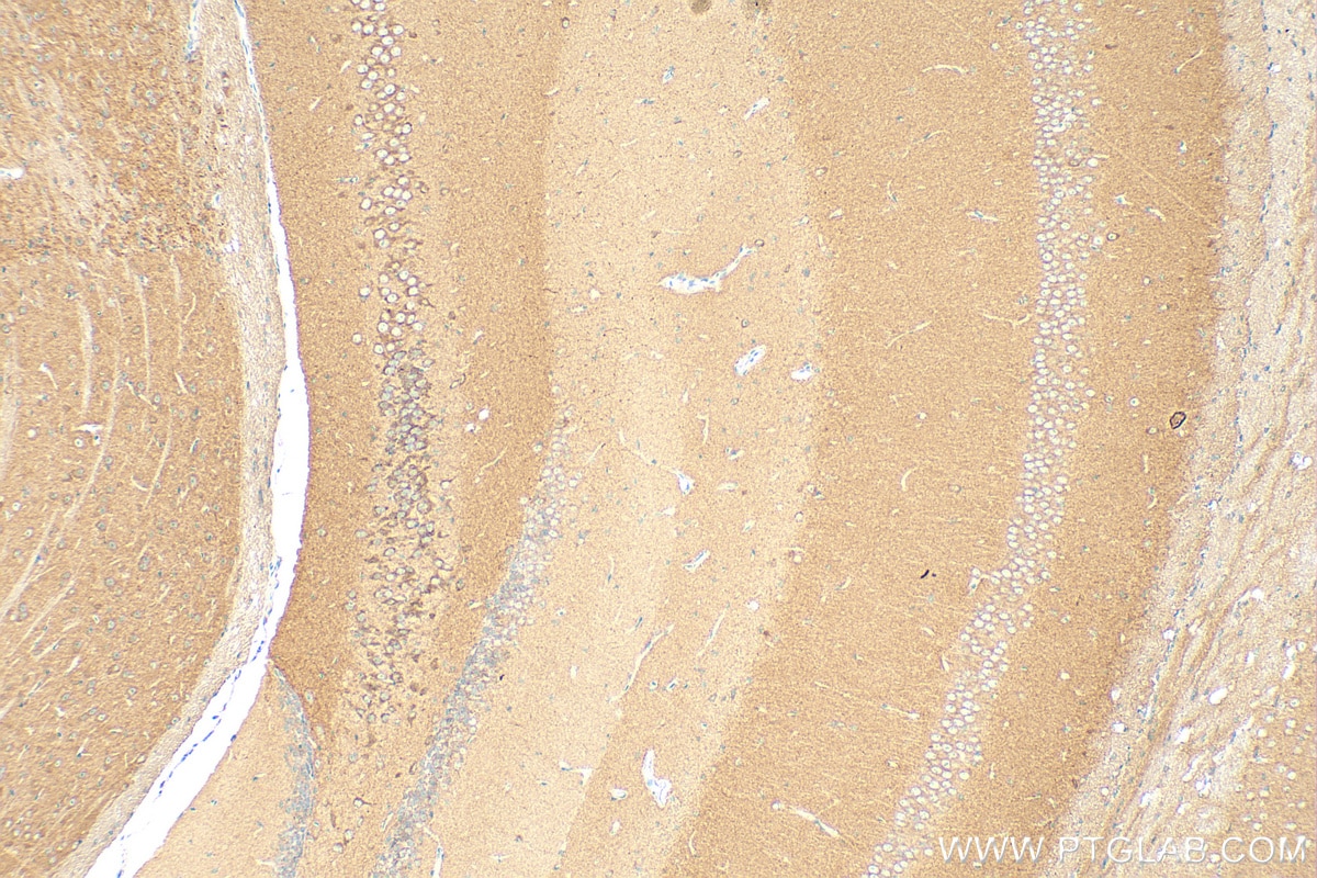 Immunohistochemistry (IHC) staining of mouse brain tissue using BRINP2 Polyclonal antibody (26884-1-AP)