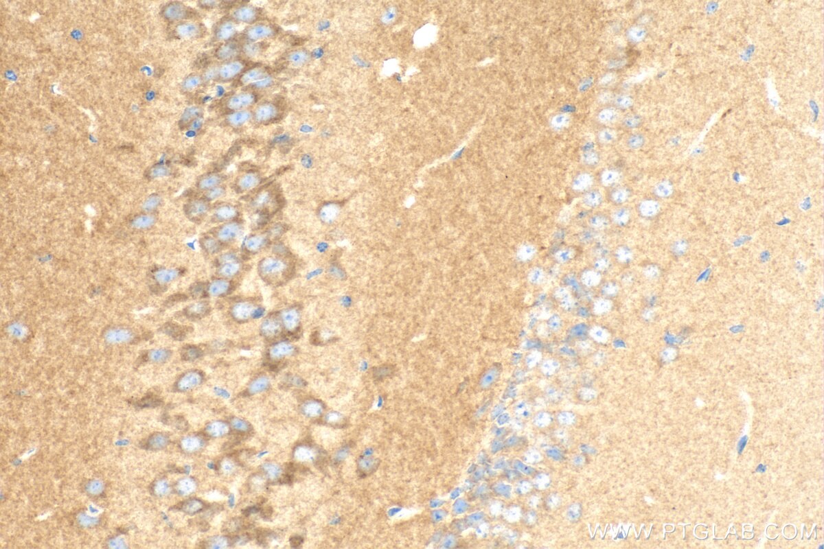 Immunohistochemistry (IHC) staining of mouse brain tissue using BRINP2 Polyclonal antibody (26884-1-AP)