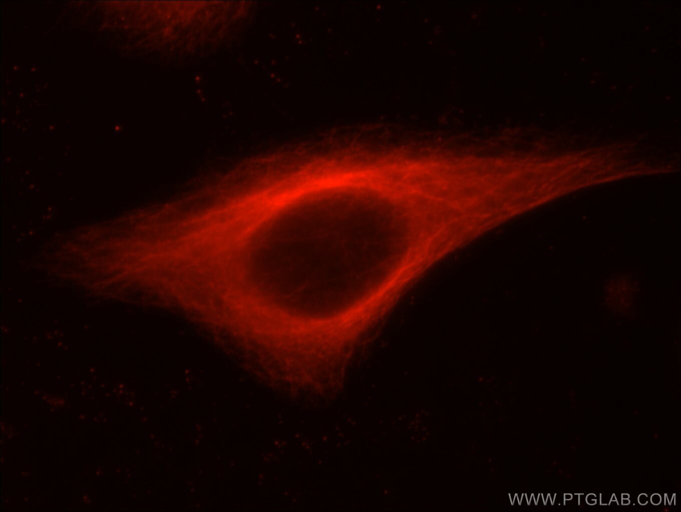 Immunofluorescence (IF) / fluorescent staining of HeLa cells using BRIP1(C-terminal) Polyclonal antibody (20983-1-AP)