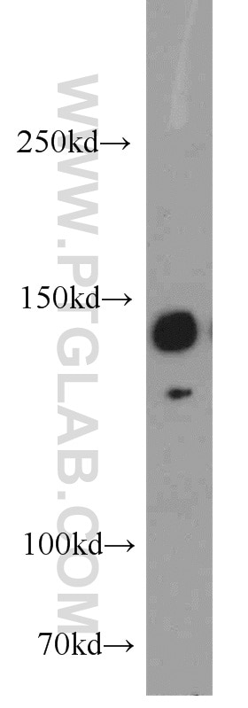 Western Blot (WB) analysis of HeLa cells using BRIP1(C-terminal) Polyclonal antibody (20983-1-AP)