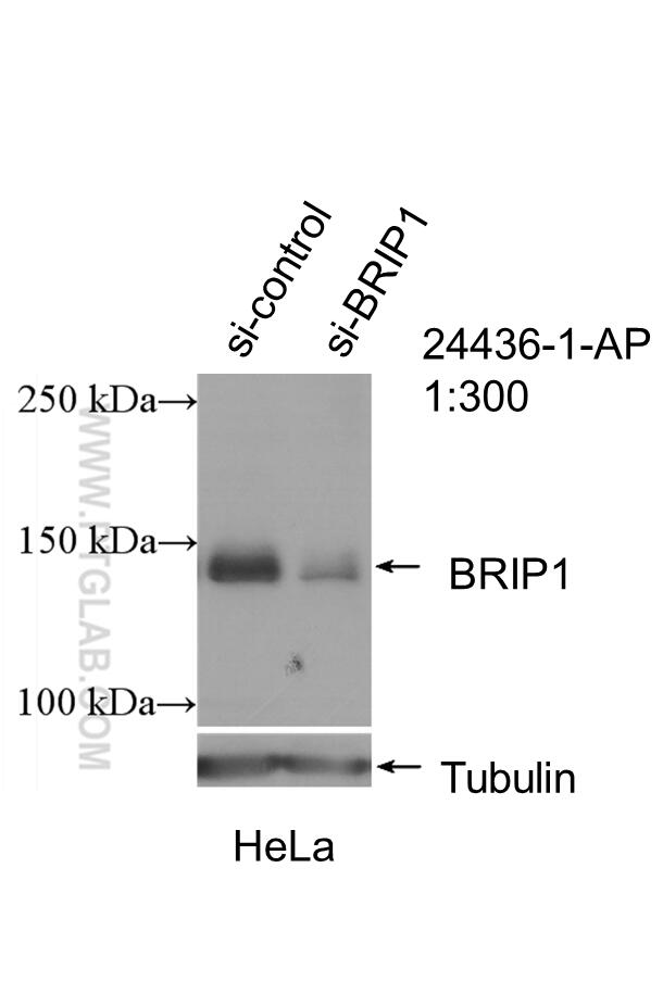 Western Blot (WB) analysis of HeLa cells using BRIP1(N-terminal) Polyclonal antibody (24436-1-AP)