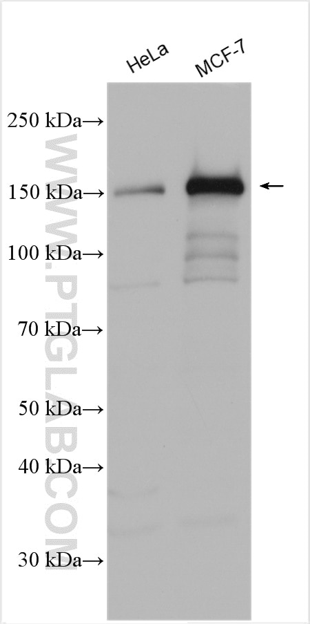 Western Blot (WB) analysis of various lysates using BRIP1(N-terminal) Polyclonal antibody (24436-1-AP)
