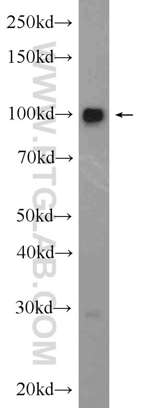 BRIP1(N-terminal)