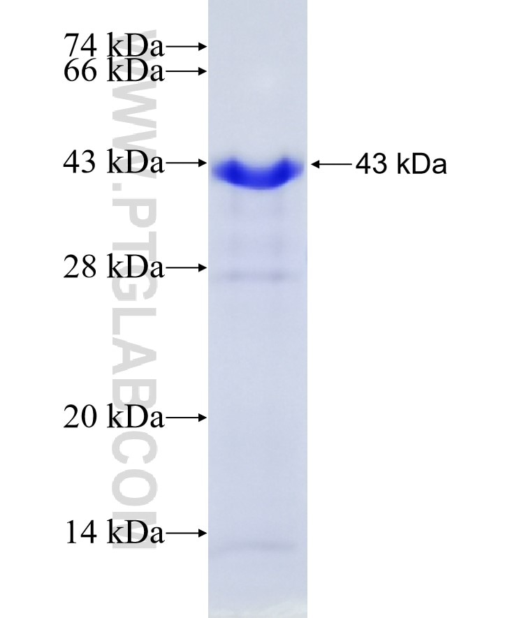 BRIP1 fusion protein Ag19907 SDS-PAGE