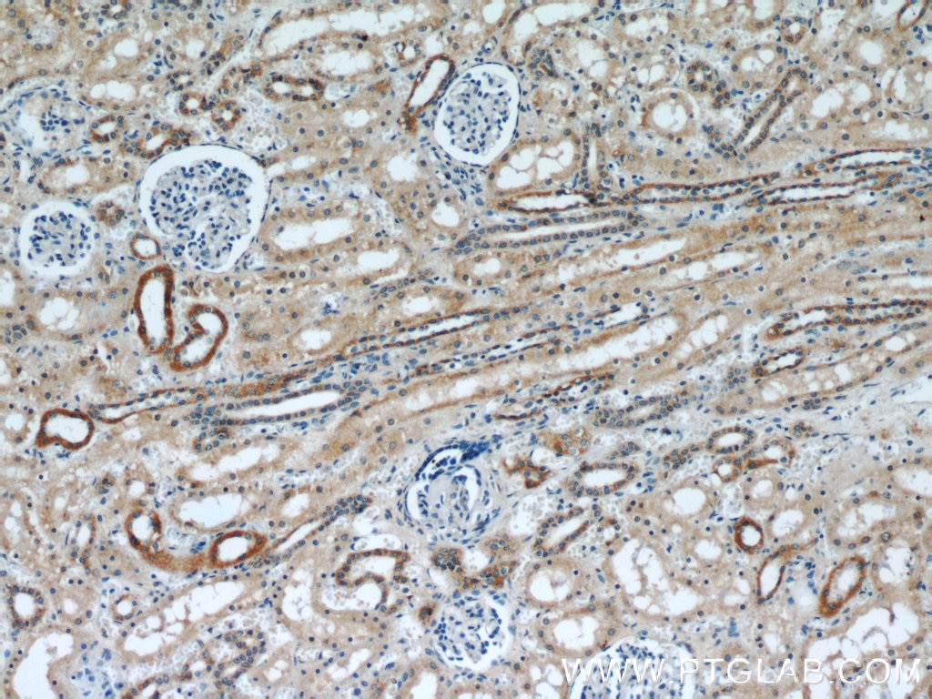 Immunohistochemistry (IHC) staining of human kidney tissue using MCPH/BRIT1 Polyclonal antibody (11962-1-AP)