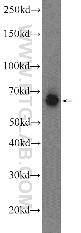 Western Blot (WB) analysis of MDA-MB-453s cells using MCPH/BRIT1 Polyclonal antibody (11962-1-AP)
