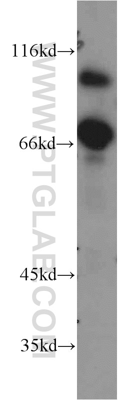 Western Blot (WB) analysis of L02 cells using MCPH/BRIT1 Polyclonal antibody (11962-1-AP)