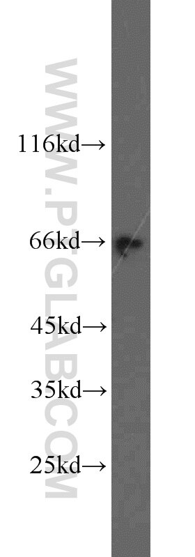 WB analysis of MDA-MB-453s using 11962-1-AP