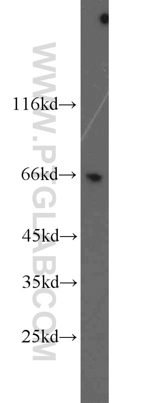 Western Blot (WB) analysis of MDA-MB-453s cells using MCPH/BRIT1 Polyclonal antibody (11962-1-AP)