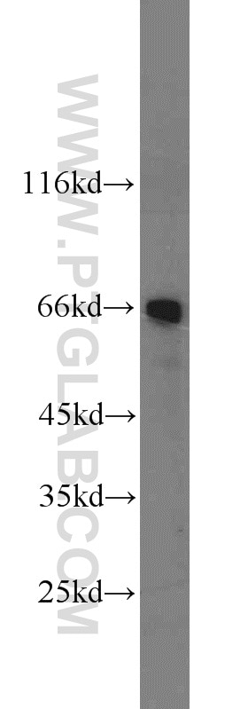 Western Blot (WB) analysis of mouse ovary tissue using MCPH/BRIT1 Polyclonal antibody (11962-1-AP)