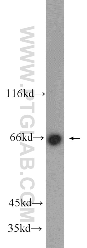 Western Blot (WB) analysis of MDA-MB-453s cells using MCPH/BRIT1 Polyclonal antibody (11962-1-AP)