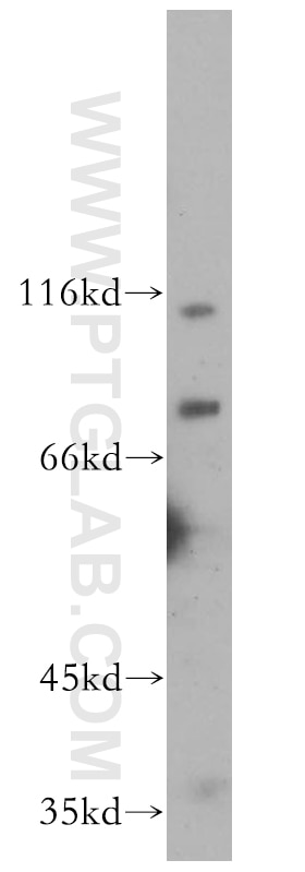 Western Blot (WB) analysis of HeLa cells using MCPH/BRIT1 Polyclonal antibody (11962-1-AP)