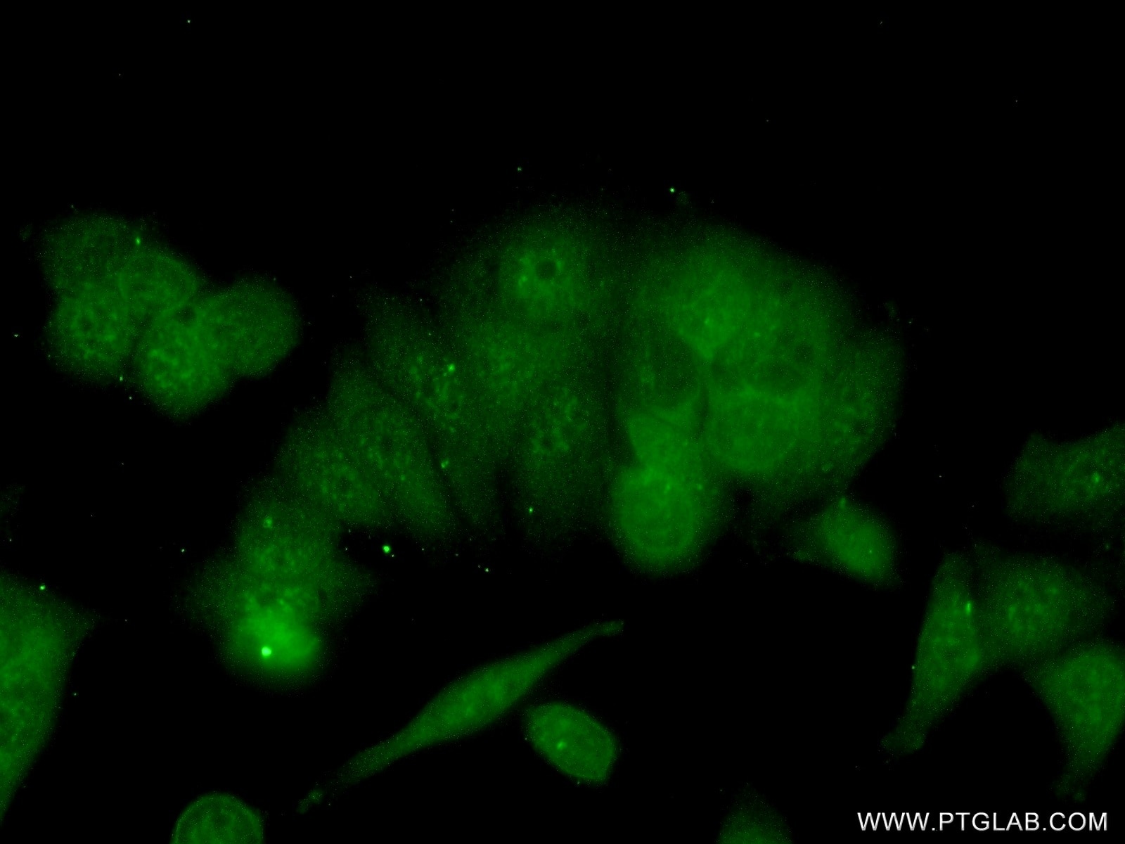 IF Staining of MCF-7 using 16096-1-AP