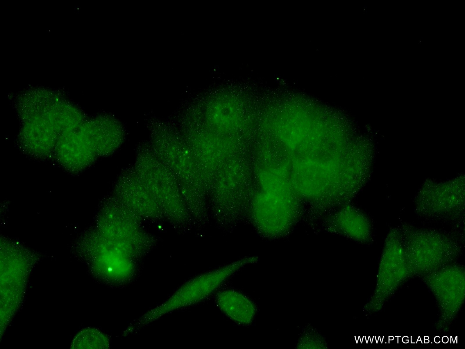 Immunofluorescence (IF) / fluorescent staining of MCF-7 cells using BRMS1 Polyclonal antibody (16096-1-AP)