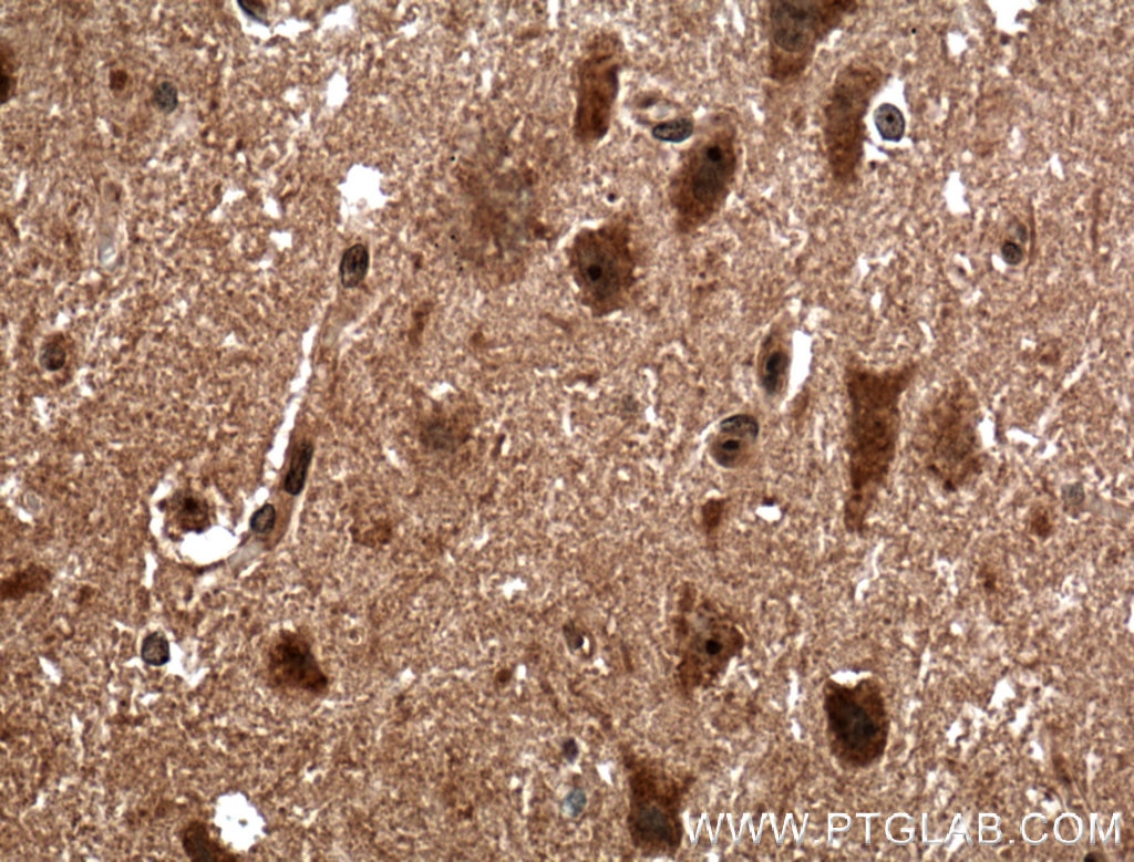 Immunohistochemistry (IHC) staining of human brain tissue using BRMS1 Polyclonal antibody (16096-1-AP)