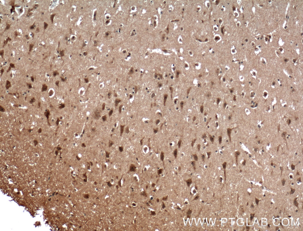 IHC staining of human brain using 16096-1-AP