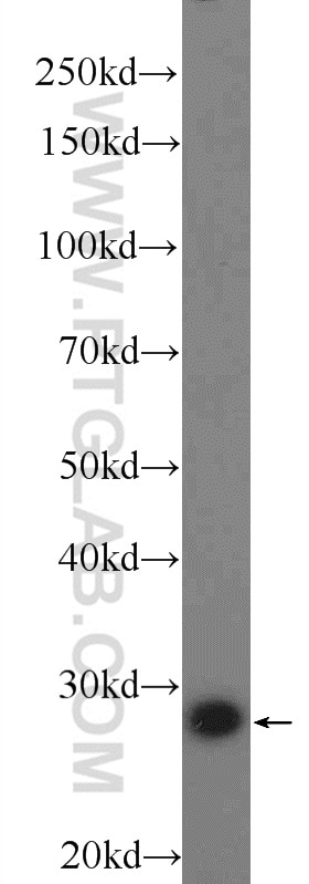 Western Blot (WB) analysis of HEK-293 cells using BRMS1 Polyclonal antibody (16096-1-AP)