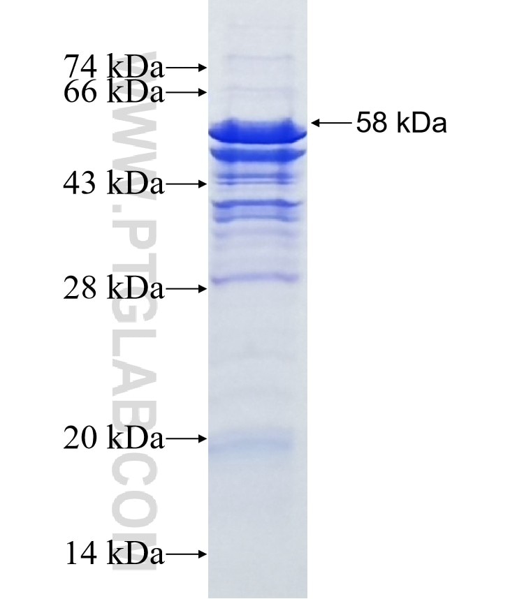 BRMS1 fusion protein Ag8939 SDS-PAGE