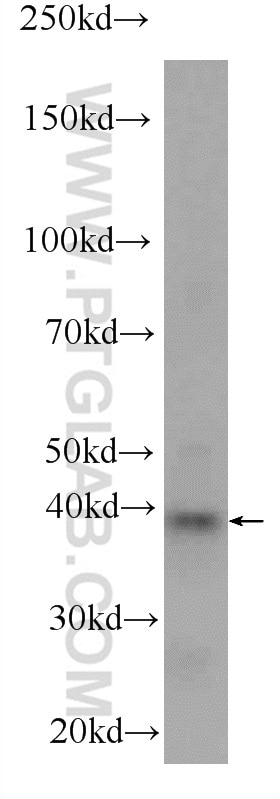 Western Blot (WB) analysis of HeLa cells using BRMS1L Polyclonal antibody (23989-1-AP)