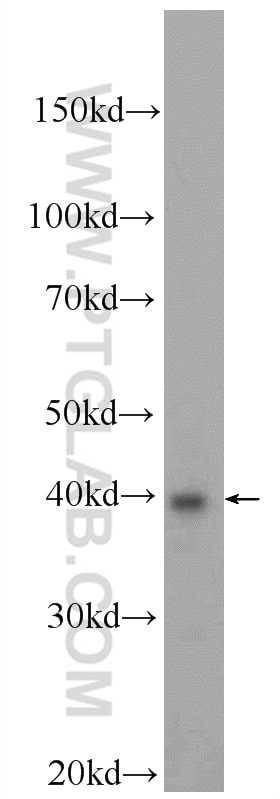 Western Blot (WB) analysis of MCF-7 cells using BRMS1L Polyclonal antibody (23989-1-AP)