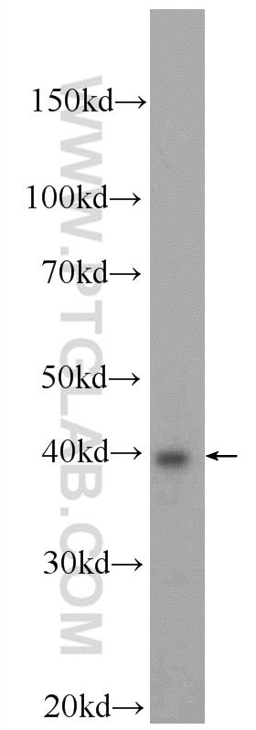 WB analysis of MCF-7 using 23989-1-AP