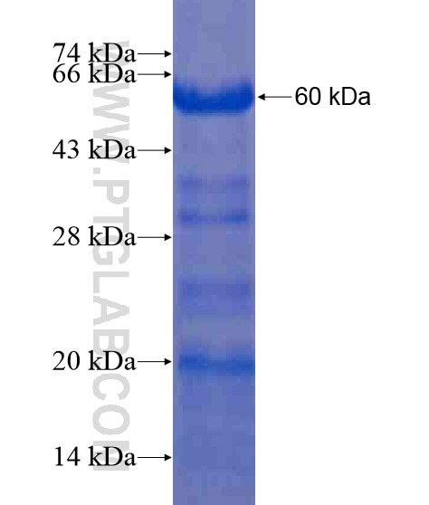 BRMS1L fusion protein Ag21145 SDS-PAGE