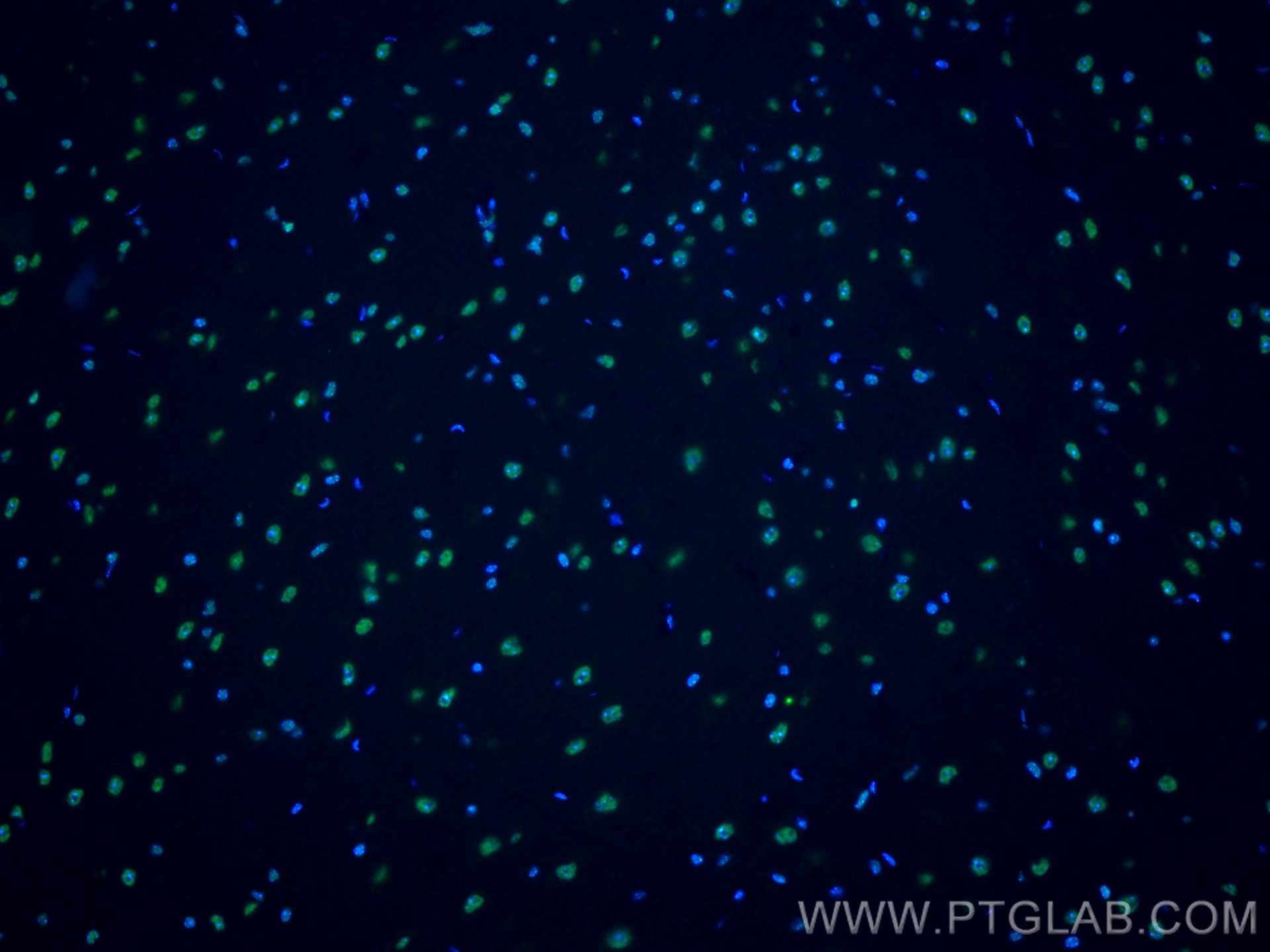 Immunofluorescence (IF) / fluorescent staining of mouse brain tissue using CoraLite® Plus 488-conjugated BRN2 Polyclonal anti (CL488-14596)