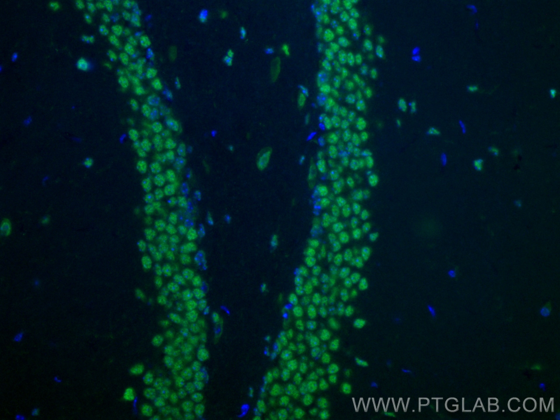 Immunofluorescence (IF) / fluorescent staining of mouse brain tissue using CoraLite® Plus 488-conjugated BRN2 Polyclonal anti (CL488-14596)