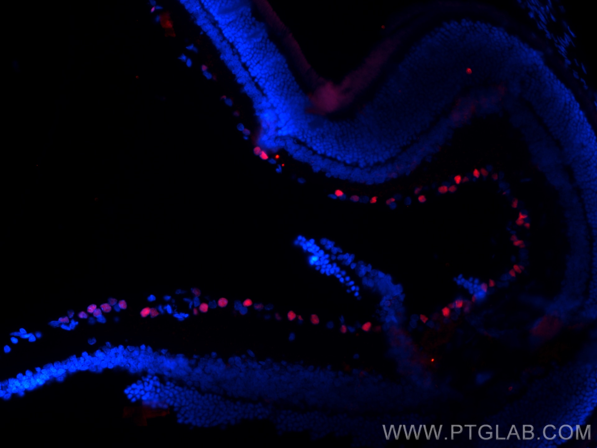 Immunofluorescence (IF) / fluorescent staining of rat eye tissue using BRN3A Polyclonal antibody (32257-1-AP)