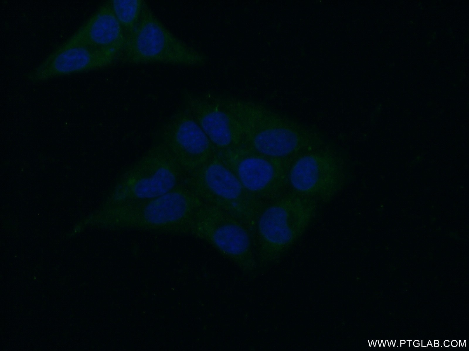 Immunofluorescence (IF) / fluorescent staining of HepG2 cells using BRP16 Polyclonal antibody (20169-1-AP)