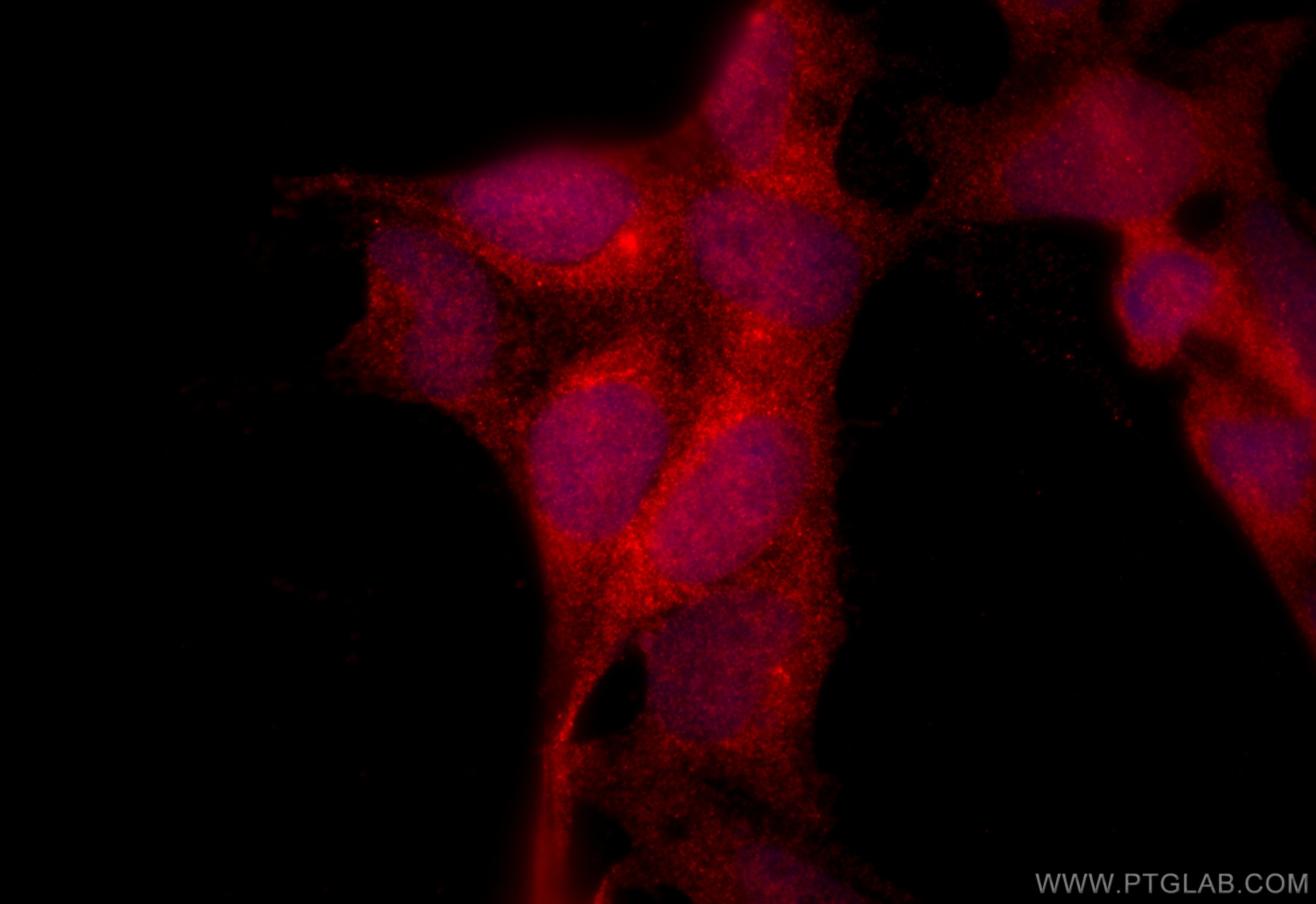 Immunofluorescence (IF) / fluorescent staining of HEK-293 cells using BRP16 Polyclonal antibody (20169-1-AP)
