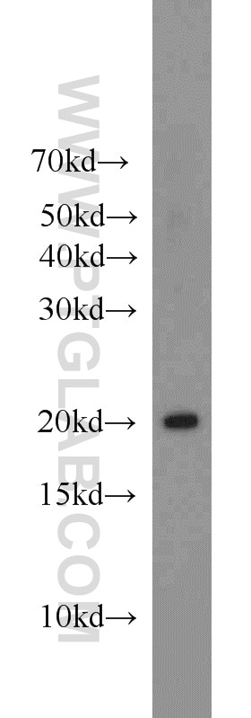 Western Blot (WB) analysis of mouse brain tissue using MPC2 Polyclonal antibody (20049-1-AP)