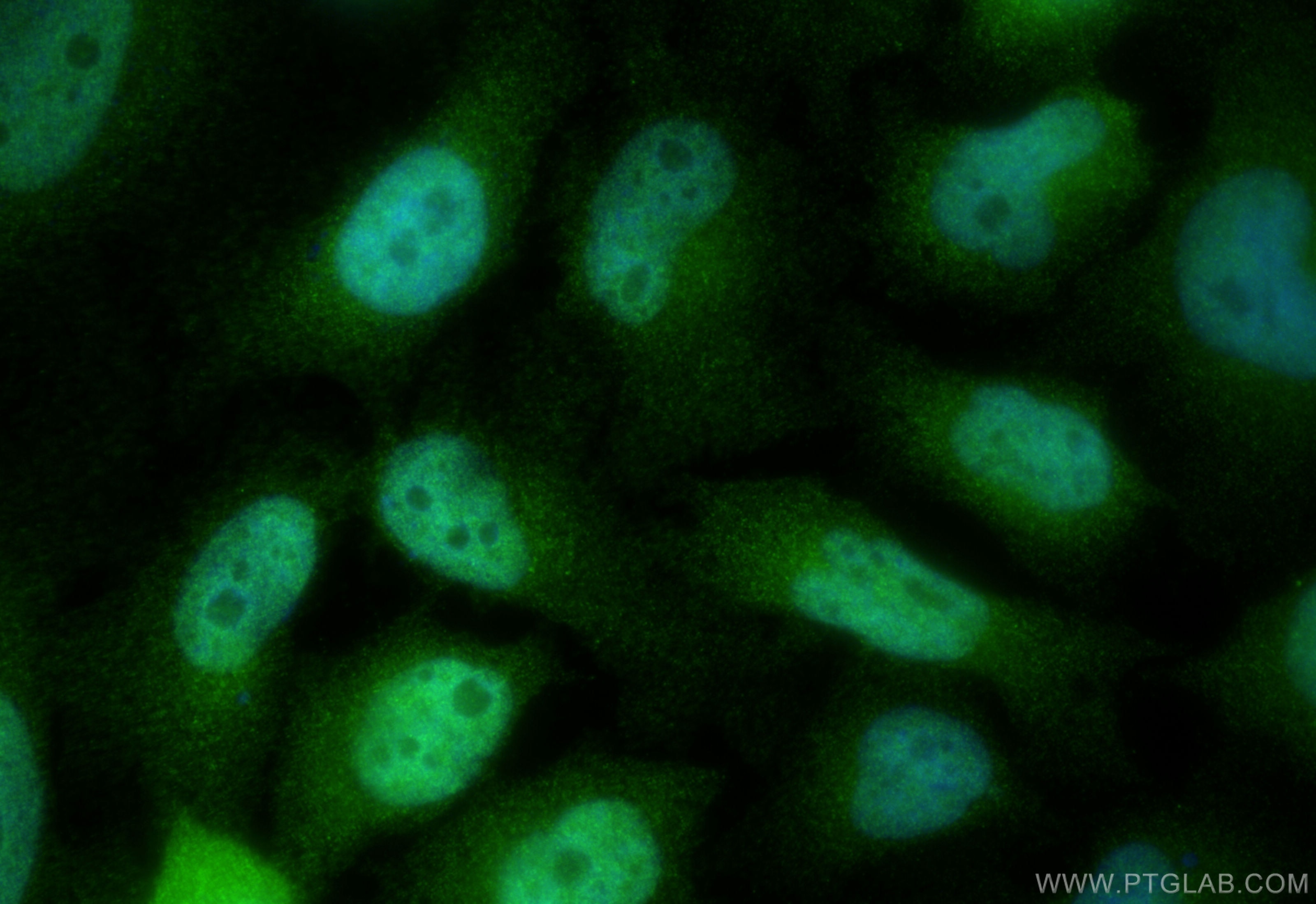 Immunofluorescence (IF) / fluorescent staining of HeLa cells using BRPF1 Polyclonal antibody (30186-1-AP)