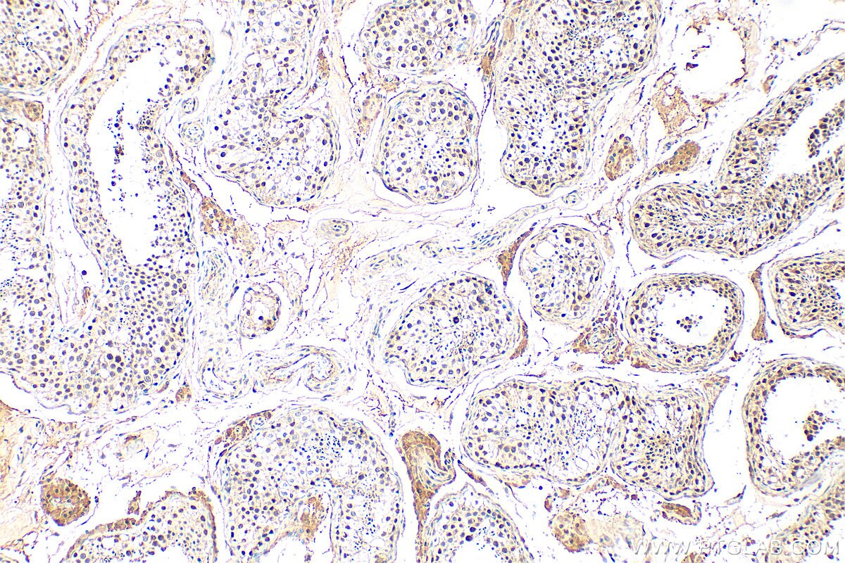 Immunohistochemistry (IHC) staining of human testis tissue using BRPF1 Polyclonal antibody (30186-1-AP)