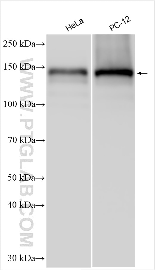 Western Blot (WB) analysis of various lysates using BRPF1 Polyclonal antibody (30186-1-AP)