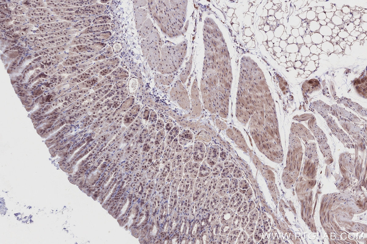 Immunohistochemistry (IHC) staining of mouse stomach tissue using BRSK1 Polyclonal antibody (12673-1-AP)