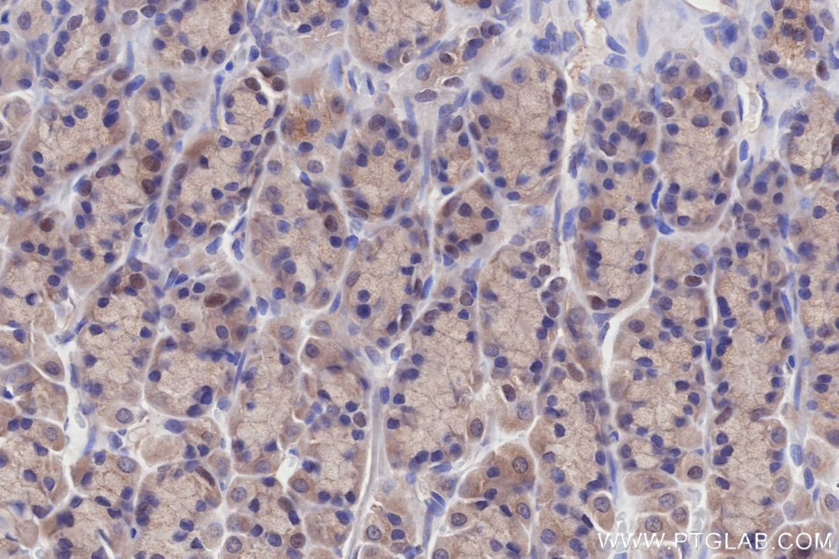 Immunohistochemistry (IHC) staining of rat stomach tissue using BRSK1 Polyclonal antibody (12673-1-AP)