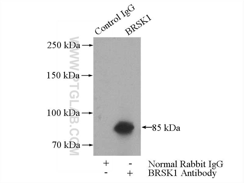 Immunoprecipitation (IP) experiment of mouse brain tissue using BRSK1 Polyclonal antibody (12673-1-AP)