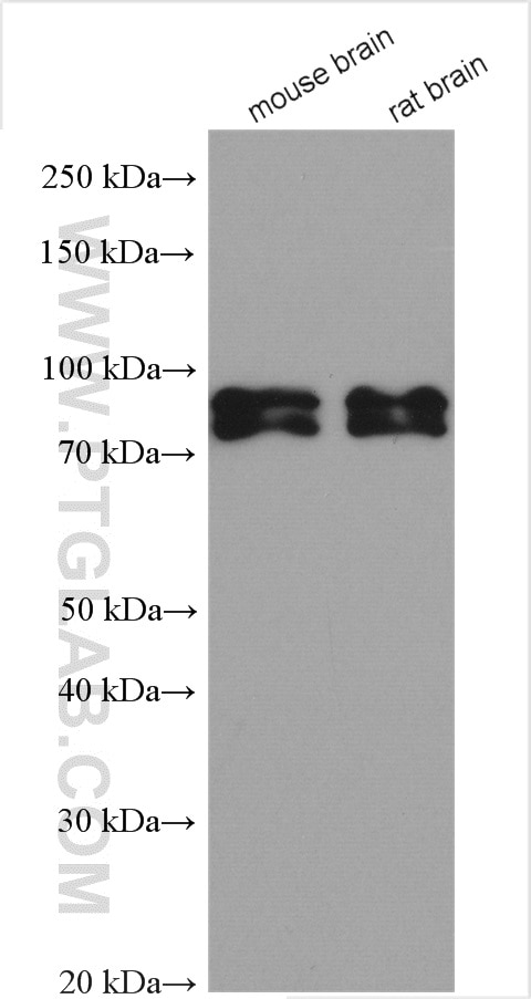 Western Blot (WB) analysis of various lysates using BRSK1 Polyclonal antibody (12673-1-AP)