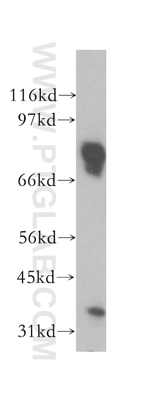 Western Blot (WB) analysis of human brain tissue using BRSK1 Polyclonal antibody (12673-1-AP)