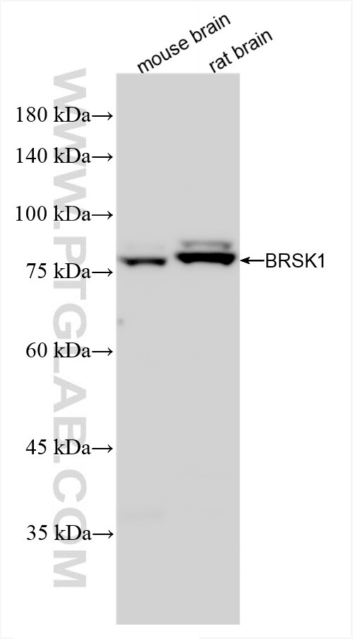Western Blot (WB) analysis of various lysates using BRSK1 Recombinant antibody (86462-1-RR)